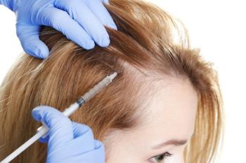 BOTOX (BOTULINUM TOXIN) ANWENDUNG BEI HAARAUSFALL